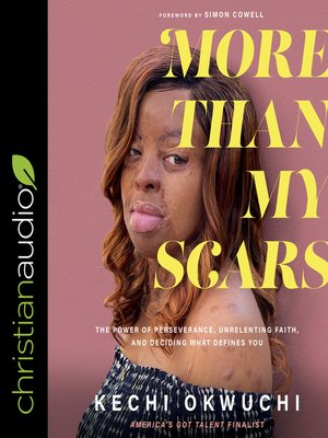 cover image of More Than My Scars